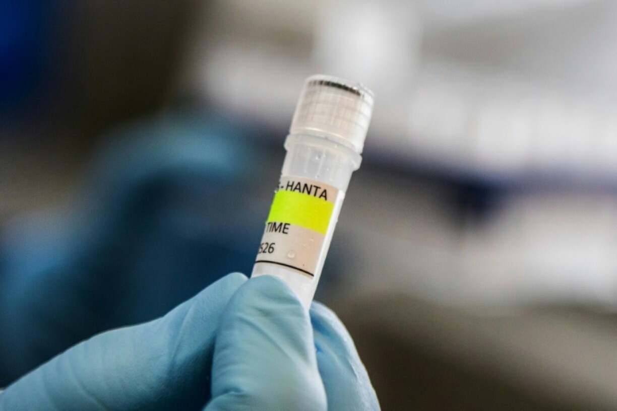 Photo diffusée par le ministère argentin de la Santé montrant un scientifique de l'Institut Malbrán tenant un tube utilisé pour diagnostiquer l'hantavirus andin, le 6 mai 2026 à Buenos Aires