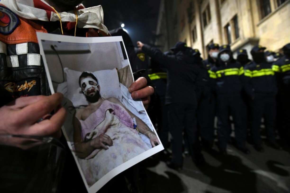 Georgia's government has faced persistent accusations of deploying plainclothed security agents to target and attack political opponents