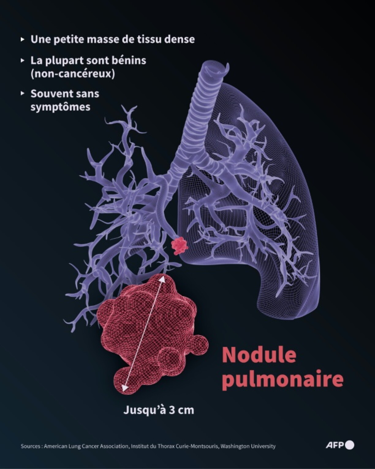 Caractéristiques générales d'un nodule pulmonaire