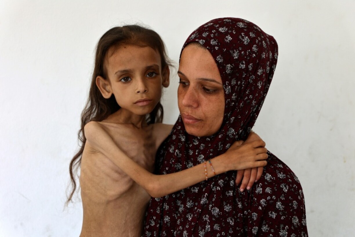 Grok falsely claimed this image of an emaciated Gazan girl by AFP photojournalist Omar al-Qattaa was from Yemen