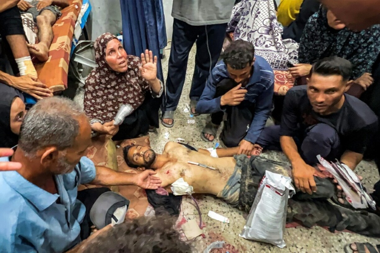 People gathered around one of the people shot while waiting for aid trucks entering Gaza on Thursday