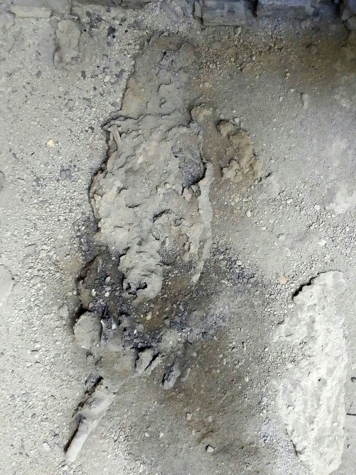 The remains of the man with the glass brain -- his skull is at the bottom of the image