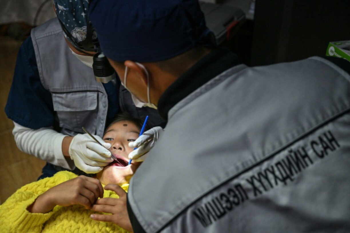 Around nine out of 10 children across Mongolia have tooth decay, according to Misheel Kids Foundation's pediatric dentist and project manager Namuunaa