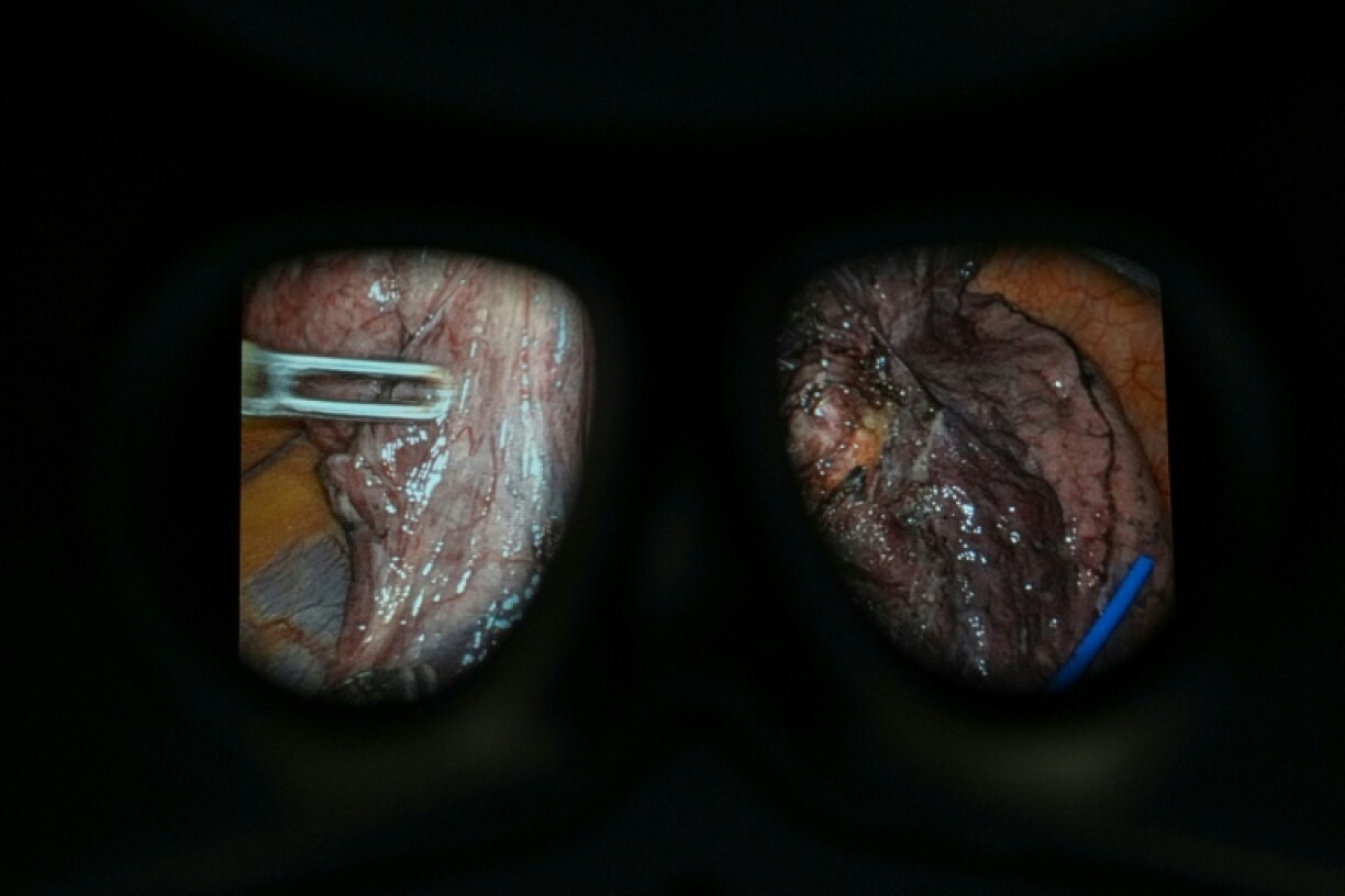 Le gouvernement s'est fixé pour objectif que la chirurgie robot-assistée soit utilisée dans neuf interventions par cœlioscopie sur dix en Angleterre d'ici à 2035
