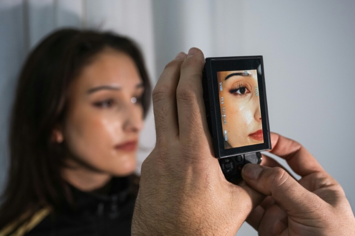 AI tends to create a characteristic face type, which differs from generator to generator, said Carl-Axel Wahlstrom